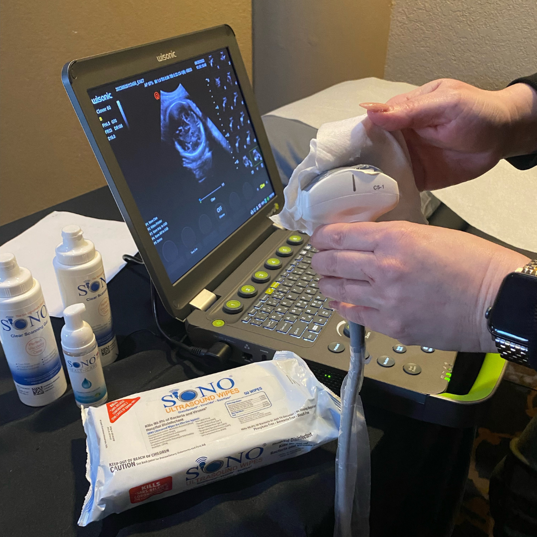 Bulk SONO Ultrasound Cleaning & Gel Combo Kit