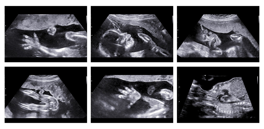 THE IMPORTANCE OF USING QUALITY ULTRASOUND GEL IN YOUR MEDICAL PRACTICE