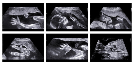 THE IMPORTANCE OF USING QUALITY ULTRASOUND GEL IN YOUR MEDICAL PRACTICE