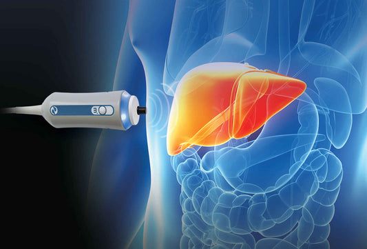 The FibroScan® Standard: Why the Wipe You Use on Your Echosens Probe Matters More Than You Think