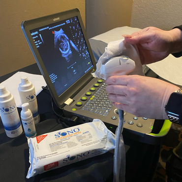 Bulk SONO Ultrasound Cleaning & Gel Combo Kit