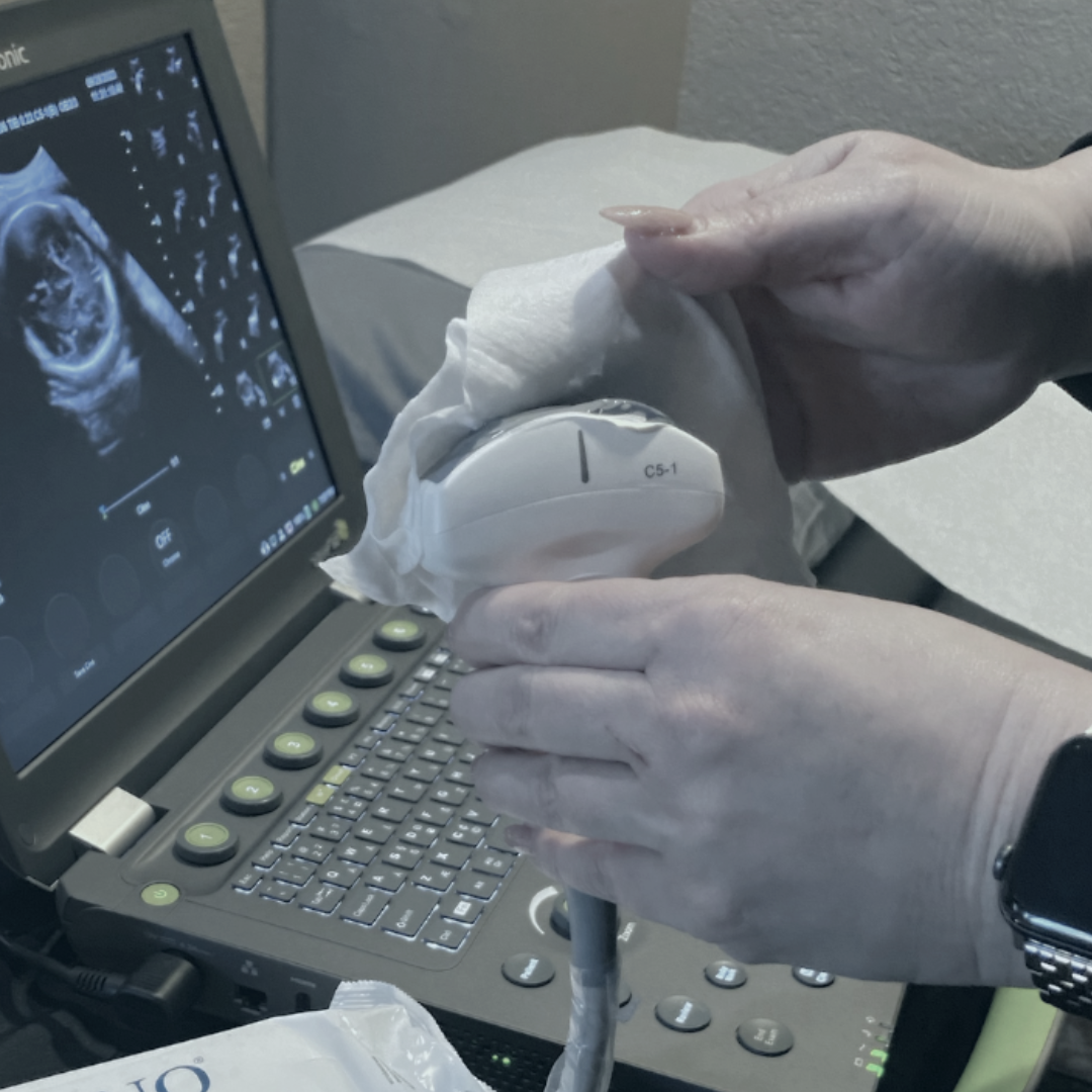 Person using an ultrasound machine with a monitor displaying an image of a fetus.